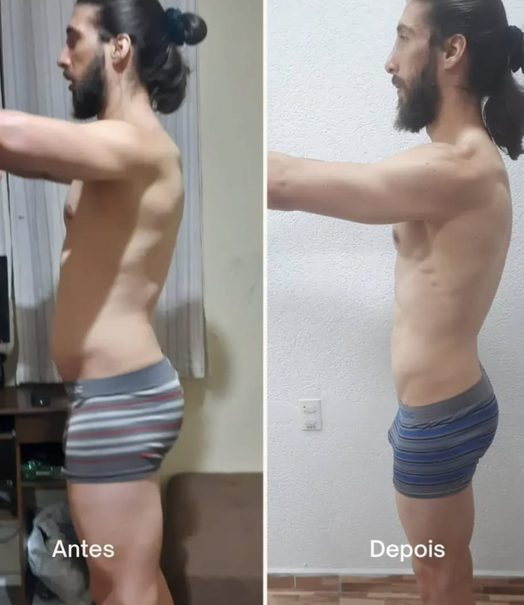 Avaliacao-nutricional-antes-depois-osasco-nutricionista-esportivo-emagrecimento-clinica-nutricional-dr-augusto-oliveira_009